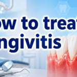 How to Treat Gingivitis